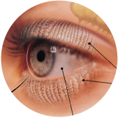 Black lines point to different parts of the eye.
